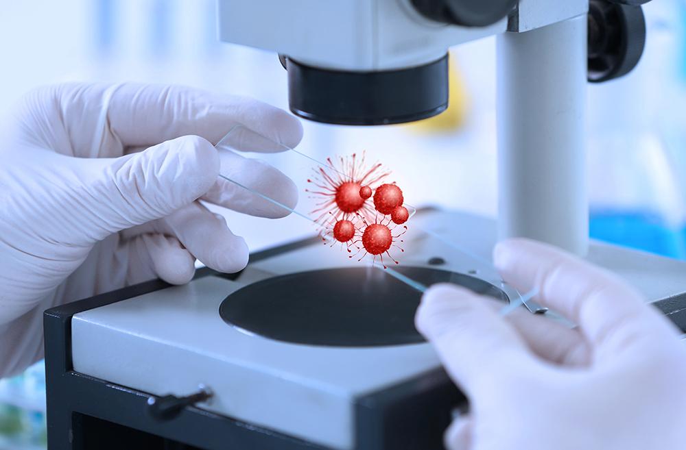 ​  New cell therapy shows promising results in advanced tumor diseases