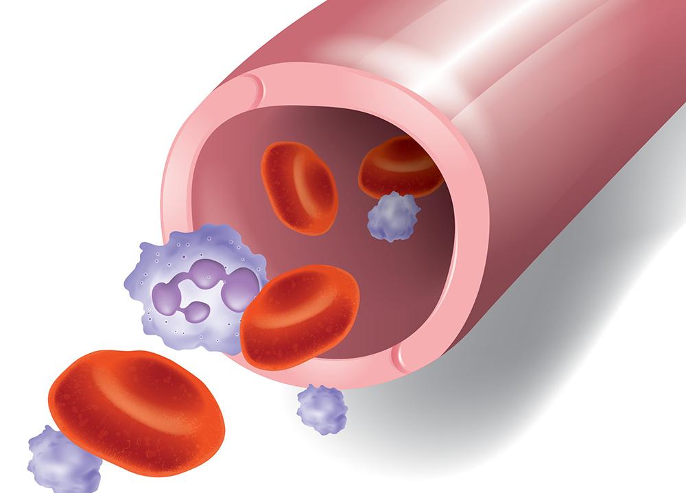 Blood vessel cells and chronic inflammation of obesity