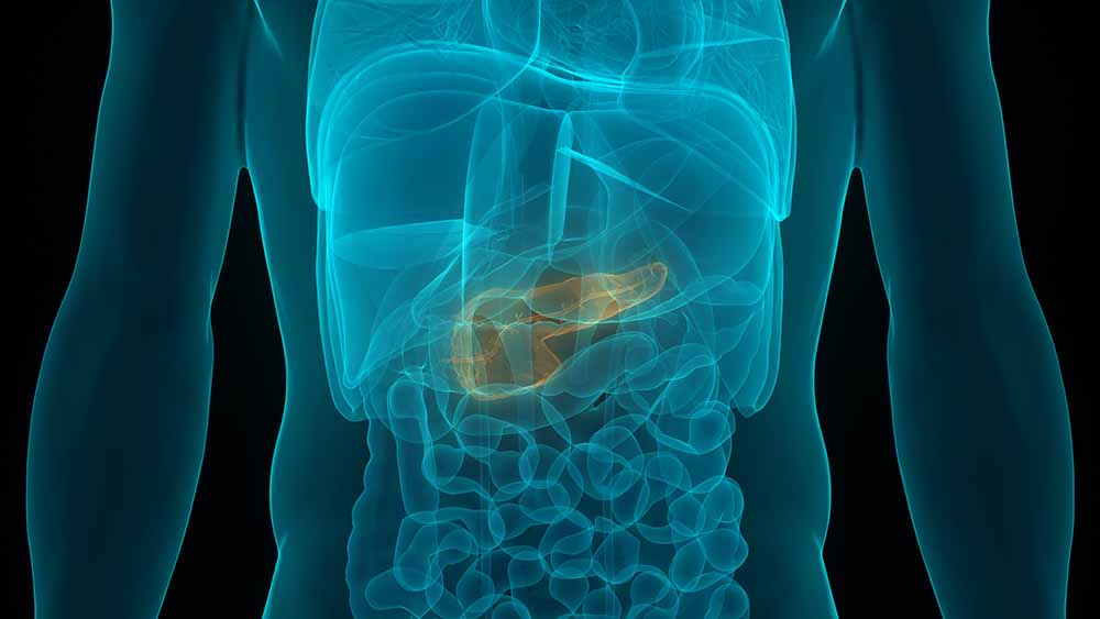 Cancer vaccine, antibody spark immune system response in pancreatic cancers