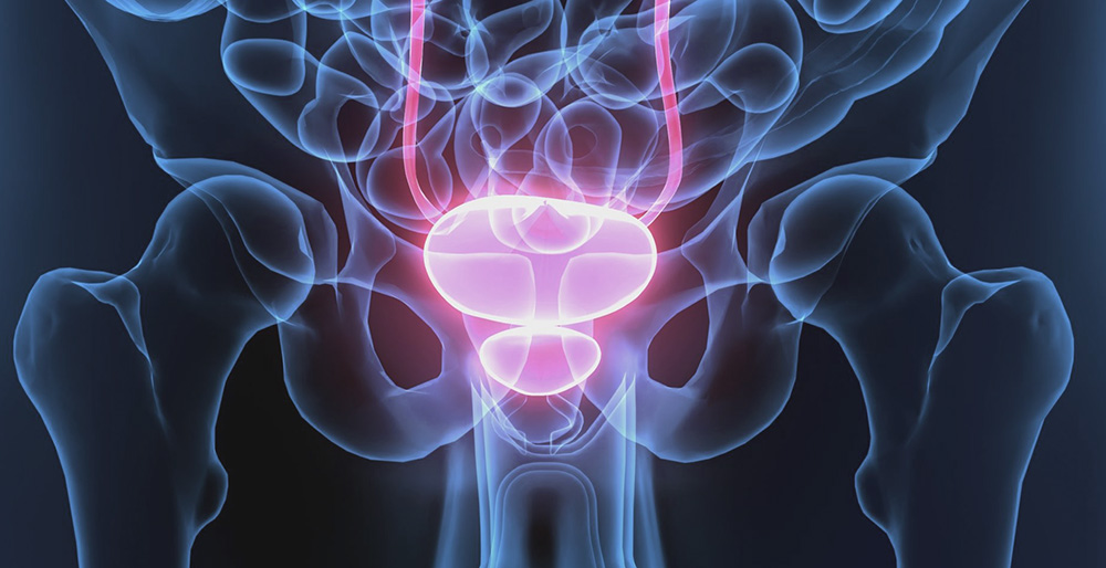 New staging system for prostate cancer